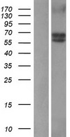 BMPR1A Human Over-expression Lysates NM_004329