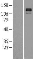 BMPR2 Human Over-expression Lysates NM_001204