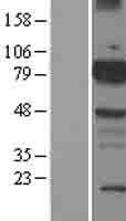ls000660 bmx human over expression lysates nm 203281 wb testing 1