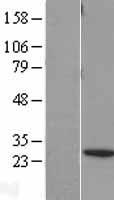 BNIP1 Human Over-expression Lysates NM_001205