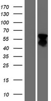 FOXL2 Human Over-expression Lysates NM_023067