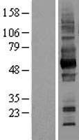 CD147 (BSG) Human Over-expression Lysates NM_001728