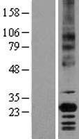 CD147 (BSG) Human Over-expression Lysates NM_198591