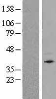 Bone marrow stromal cell antigen 1 (BST1) Human Over-expression Lysates NM_004334
