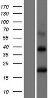 BST2 Human Over-expression Lysates NM_004335