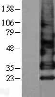 Betacellulin (BTC) Human Over-expression Lysates NM_001729