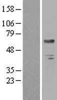 BTD Human Over-expression Lysates NM_000060