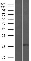 BTF3 Human Over-expression Lysates NM_001207