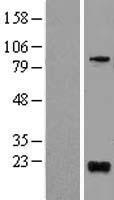 BTG1 Human Over-expression Lysates NM_001731