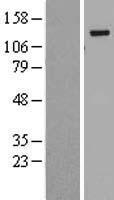 BubR1 (BUB1B) Human Over-expression Lysates NM_001211
