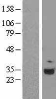 C1QA Human Over-expression Lysates NM_015991