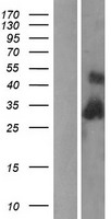 C1QB Human Over-expression Lysates NM_000491