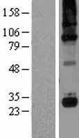 C1QC Human Over-expression Lysates NM_172369