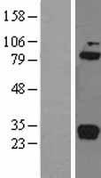 C1R Human Over-expression Lysates NM_001733