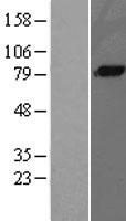 C1S Human Over-expression Lysates NM_001734