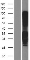 ls000725 c4bpb human over expression lysates nm 001017364 wb testing 2