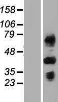 ls000725 c4bpb human over expression lysates nm 001017365 wb testing 3
