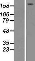 Complement C5 (C5) Human Over-expression Lysates NM_001735