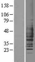 C5R1 (C5AR1) Human Over-expression Lysates NM_001736