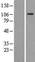 Complement Component 6 (C6) Human Over-expression Lysates NM_001115131