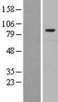 ls000730 complement c7 c7 human over expression lysates nm 000587 wb testing 1