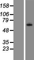 ls000732 complement factor 8 beta c8b human over expression lysates nm 000066 wb testing 1