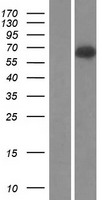 Complement C9 (C9) Human Over-expression Lysates NM_001737