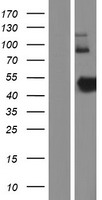 ZNHIT2 Human Over-expression Lysates NM_014205