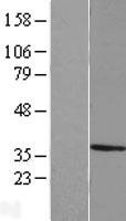 MPPED2 Human Over-expression Lysates NM_001584