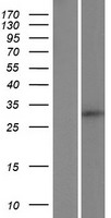 C18orf1 (LDLRAD4) Human Over-expression Lysates NM_001003674
