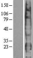 PTTG1IP Human Over-expression Lysates NM_004339
