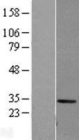 ls000759 carbonic anhydrase i ca1 human over expression lysates nm 001738 wb testing 2