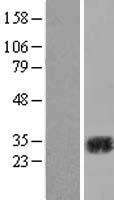 ls000760 carbonic anhydrase ii ca2 human over expression lysates nm 000067 wb testing 1