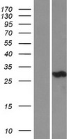 ls000761 carbonic anhydrase iii ca3 human over expression lysates nm 005181 wb testing 1