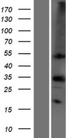 ls000762 carbonic anhydrase iv ca4 human over expression lysates nm 000717 wb testing 1