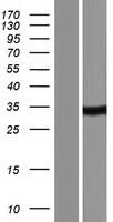 CA5A Human Over-expression Lysates NM_001739