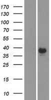 CA6 Human Over-expression Lysates NM_001215