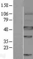 ls000768 carbonic anhydrase ix ca9 human over expression lysates nm 001216 wb testing 1