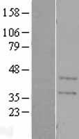 Carbonic Anhydrase XI (CA11) Human Over-expression Lysates NM_001217