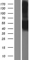 CA12 Human Over-expression Lysates NM_206925