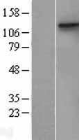 MCK10 (DDR1) Human Over-expression Lysates NM_001954