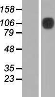 MCK10 (DDR1) Human Over-expression Lysates NM_013993