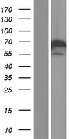 CACNB1 Human Over-expression Lysates NM_000723