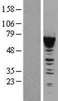 CACNB1 Human Over-expression Lysates NM_199247