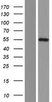 CACNB1 Human Over-expression Lysates NM_199248
