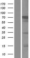 ls000783 cacnb2 human over expression lysates nm 201593 wb testing 7