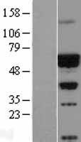 ls000785 cacnb4 human over expression lysates nm 000726 wb testing 1