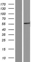 ls000785 cacnb4 human over expression lysates nm 001005747 wb testing 3