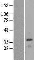 Calbindin (CALB1) Human Over-expression Lysates NM_004929