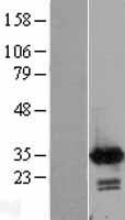 Calretinin (CALB2) Human Over-expression Lysates NM_001740